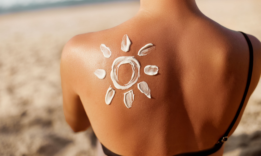 Ηλιακά εγκαύματα. Τι να κάνω;